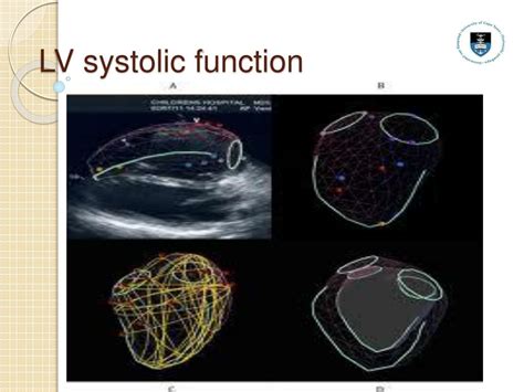 echo lv function|Lv function assessment by echo.